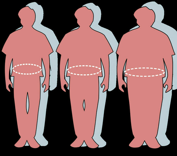 L'obesità Può Causare Depressione Individuare I Segni?